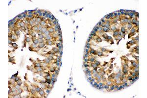 TRPM5 was detected in paraffin-embedded sections of rat testis tissues using rabbit anti- TRPM5 Antigen Affinity purified polyclonal antibody at 1 μg/mL.