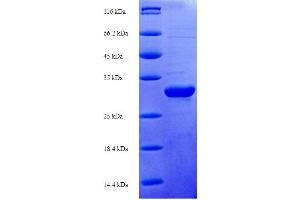 SDS-PAGE (SDS) image for S100 Calcium Binding Protein A7A (S100A7A) (AA 2-101) protein (His-SUMO Tag) (ABIN5711481)