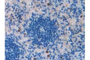 DAB staining on IHC-P; Samples: Rat Spleen Tissue (TGFB2 anticorps  (AA 331-442))
