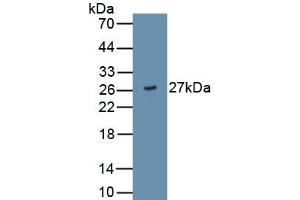 Detection of Recombinant ADAMTS9, Human using Monoclonal Antibody to A Disintegrin And Metalloproteinase With Thrombospondin 9 (ADAMTS9) (ADAMTS9 anticorps  (AA 1727-1935))