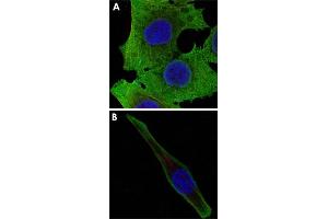 Confocal immunofluorescence analysis of PANC-1 (A) and SK-BR-3 (B) cells using SOD1 monoclonal antobody, clone 6F5  (green). (SOD1 anticorps)