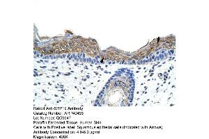 Rabbit Anti-SRAntibody  Paraffin Embedded Tissue: Human Skin Cellular Data: Squamous epithelial cells Antibody Concentration: 4. (SRP19 anticorps  (Middle Region))