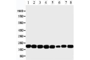 Western Blotting (WB) image for anti-Non-Metastatic Cells 1, Protein (NM23A) Expressed in (NME1) (AA 137-152), (C-Term) antibody (ABIN3044197) (NME1 anticorps  (C-Term))