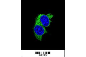 Confocal immunofluorescent analysis of MMP1 Antibody with MDA-MB231 cell followed by Alexa Fluor 488-conjugated goat anti-rabbit lgG (green). (MMP1 anticorps  (AA 317-347))
