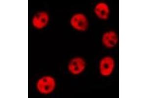 ABIN6278597 staining Hela by IF/ICC. (NOL8 anticorps  (C-Term))