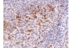 Immunohistochemistry of CAMP in human spleen tissue with CAMP polyclonal antibody  at 5 ug/mL . (Cathelicidin anticorps  (C-Term))