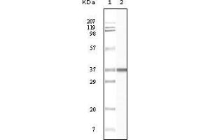 Western blot analysis using BLK mouse mAb against truncated BLK recombinant protein. (BLK anticorps)