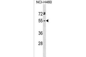 RG Antibody (C-term) (ABIN1537257 and ABIN2838199) western blot analysis in NCI- cell line lysates (35 μg/lane).