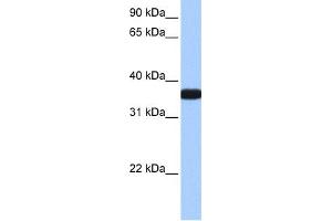 WB Suggested Anti-OCEL1 Antibody Titration:  0. (OCEL1 anticorps  (C-Term))