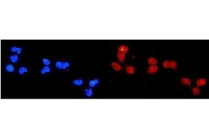 IF analysis of DDB2 using anti-DDB2 antibody (ABIN3043488). (DDB2 anticorps  (AA 1-115))