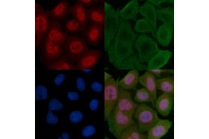 ABIN6255654 and ABIN6267462 staining Hela cells by IF/ICC. (Cyclin D3 anticorps  (pThr283))
