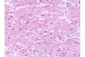 Anti-Neurokinin 1 Receptor / NK1R antibody IHC of human heart.