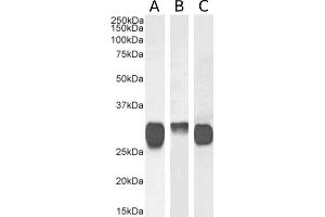 anti-HLA Class II antibody