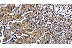 Detection of MyD88 in Mouse Kidney Tissue using Polyclonal Antibody to Myeloid Differentiation Factor 88 (MyD88) (MYD88 anticorps  (AA 32-265))