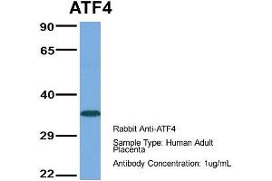 Host:  Rabbit  Target Name:  ATF4  Sample Type:  Human Adult Placenta  Antibody Dilution:  1. (ATF4 anticorps  (Middle Region))