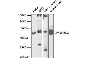 Western blot analysis of extracts of various cell lines, using SMYD2 antibody (ABIN6130910, ABIN6148167, ABIN6148168 and ABIN6222133) at 1:1000 dilution.