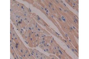 Used in DAB staining on fromalin fixed paraffin- embedded heart tissue (Esophageal Cancer Related Gene 4 (AA 32-148) anticorps)