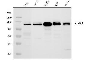 Western blot analysis of BubR1/BUB1B using anti-BubR1/BUB1B antibody (ABIN7600962). (BUB1B anticorps  (AA 26-448))