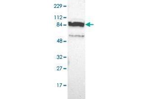 Western blot analysis of Human cell line RT-4 with PPFIBP2 polyclonal antibody  at 1:100-1:250 dilution. (PPFIBP2 anticorps)