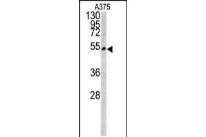 Western blot analysis of LUM antibody in A375 cell line lysates (35ug/lane) (LUM anticorps  (AA 198-227))