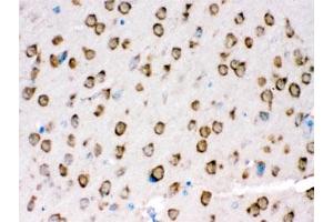 IHC testing of FFPE mouse brain with TRPM5 antibody. (TRPM5 anticorps  (AA 1021-1108))