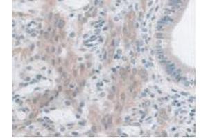 IHC-P analysis of Mouse Uterus Tissue, with DAB staining. (GLP1R anticorps  (AA 25-145))