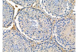ABIN6260259 and ABIN6276294 at 1/100 staining Mouse testis tissue by IHC-P. (BID anticorps  (C-Term))