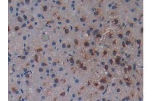DAB staining on IHC-P; Samples: Rat Adrenal Gland Tissue (Osteopontin anticorps  (AA 17-317))