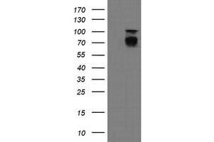 Image no. 6 for anti-Differentially Expressed in FDCP 6 Homolog (DEF6) antibody (ABIN1497808) (DEF6 anticorps)