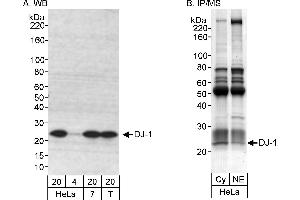 Immunoprecipitation (IP) image for anti-Parkinson Protein 7 (PARK7) (C-Term) antibody (ABIN7454672) (PARK7/DJ1 anticorps  (C-Term))