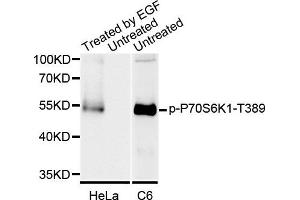 Western blot analysis of extracts of various cell lines, using Phospho-P70S6K1-T389 antibody. (RPS6KB1 anticorps)