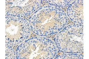 ABIN6258840 and ABIN6276280 at 1/100 staining Mouse testis tissue by IHC-P. (HCRTR1 anticorps  (C-Term))