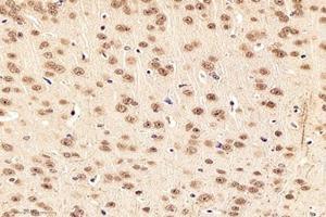Immunohistochemistry analysis of paraffin-embedded mouse striatumusing,NOS1AP (ABIN7074844) at dilution of 1:4000 (NOS1AP anticorps)