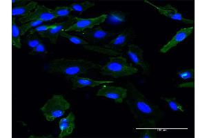 Immunofluorescence of monoclonal antibody to APOM on HeLa cell. (Apolipoprotein M anticorps  (AA 23-188))