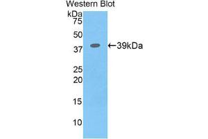 Western Blotting (WB) image for anti-Colony Stimulating Factor 2 Receptor, Beta (CSF2RB) (AA 133-233) antibody (ABIN3206477) (CD131 anticorps  (AA 133-233))