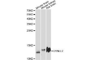 Western blot analysis of extracts of various cell lines, using DYNLL2 antibody (ABIN6292037) at 1:3000 dilution. (DYNLL2 anticorps)