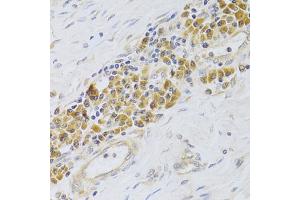 Immunohistochemistry of paraffin-embedded human esophagus using PA2G4 Antibody (ABIN5973112) at dilution of 1/100 (40x lens). (PA2G4 anticorps)