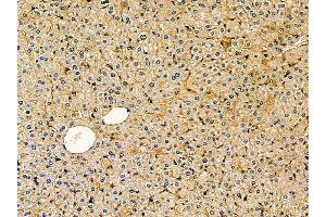 ABIN7095288 and ABIN7099345 at 1/100 staining mouse liver tissue by IHC-P. (SOCS5 anticorps)