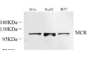 Western Blot analysis of various samples using Mineralocorticoid receptor Polyclonal Antibody at dilution of 1:600. (NR3C2 anticorps)