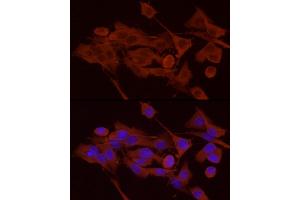 Immunofluorescence analysis of PC-12 cells using PYGB Rabbit pAb  at dilution of 1:100 (40x lens).