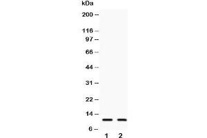 Western blot testing of Eotaxin 3 antibody and Lane 1:  COLO320;  2: A549;  Predicted size: 11KD;  Observed size: 11KD