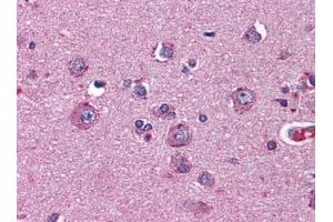 Immunohistochemistry (IHC) image for anti-Netrin G2 (NTNG2) (AA 21-120) antibody (ABIN614733)