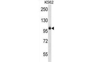 Western Blotting (WB) image for anti-PTK2B Protein tyrosine Kinase 2 beta (PTK2B) antibody (ABIN2997867) (PTK2B anticorps)