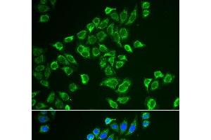 Immunofluorescence analysis of HeLa cells using TAGLN Polyclonal Antibody (Transgelin anticorps)