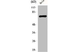 Western Blot analysis of HeLa cells using Phospho-LIMK-1/2 (T508/505) Polyclonal Antibody (LIM Domain Kinase 1/2 (LIMK1/2) (pThr505), (pThr508) anticorps)