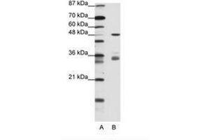 Image no. 2 for anti-PHD Finger Protein 1 (PHF1) (AA 421-470) antibody (ABIN202770) (PHF1 anticorps  (AA 421-470))