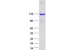 Validation with Western Blot