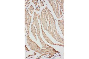 Anti-VDAC/Porin antibody, IHC(P) IHC(P): Rat Cardiac Muscle Tissue