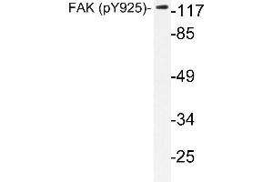 Western blot (WB) analyzes of p-FAK antibody in extracts from HepG2 cells. (FAK anticorps  (pTyr925))