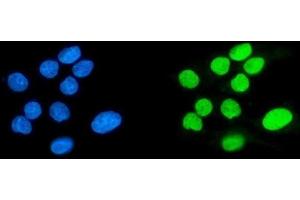 IF analysis of SPHK1 using anti-SPHK1 antibody (ABIN7600168).